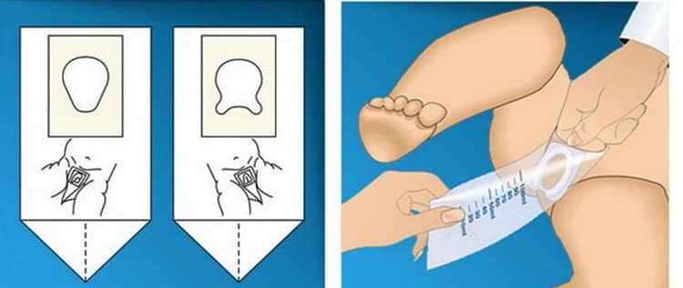 Как пользоваться мочеприемником для новорожденных мальчиков фото